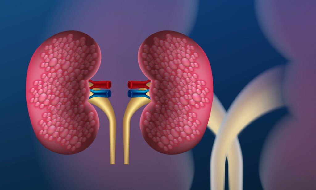 Dialysis care|Blog Post Picture